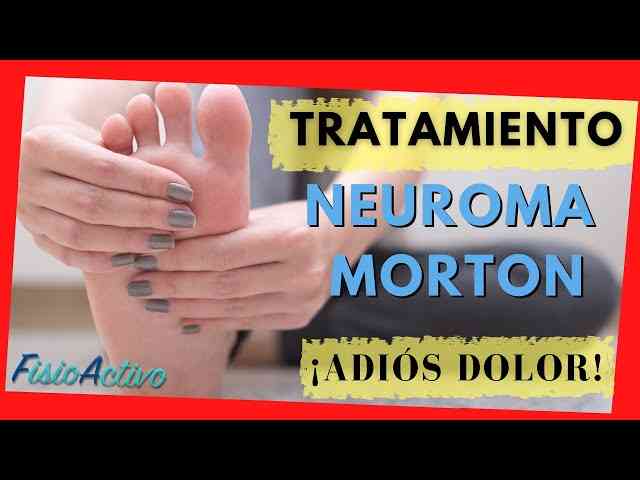 Guía completa sobre el neuroma de Morton alivio del dolor tiempo de