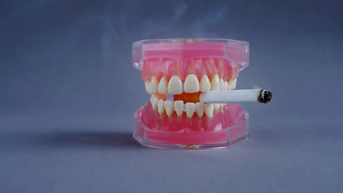 Impacto Del Tabaco En La Durabilidad De Los Implantes Dentales Estudio