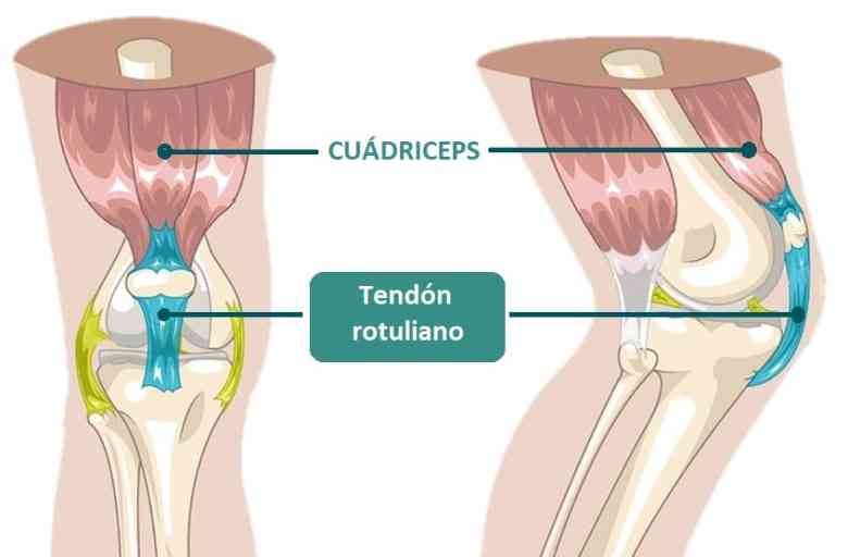 Gu A De Recuperaci N Para Lesiones En El Tend N Rotuliano Neurat