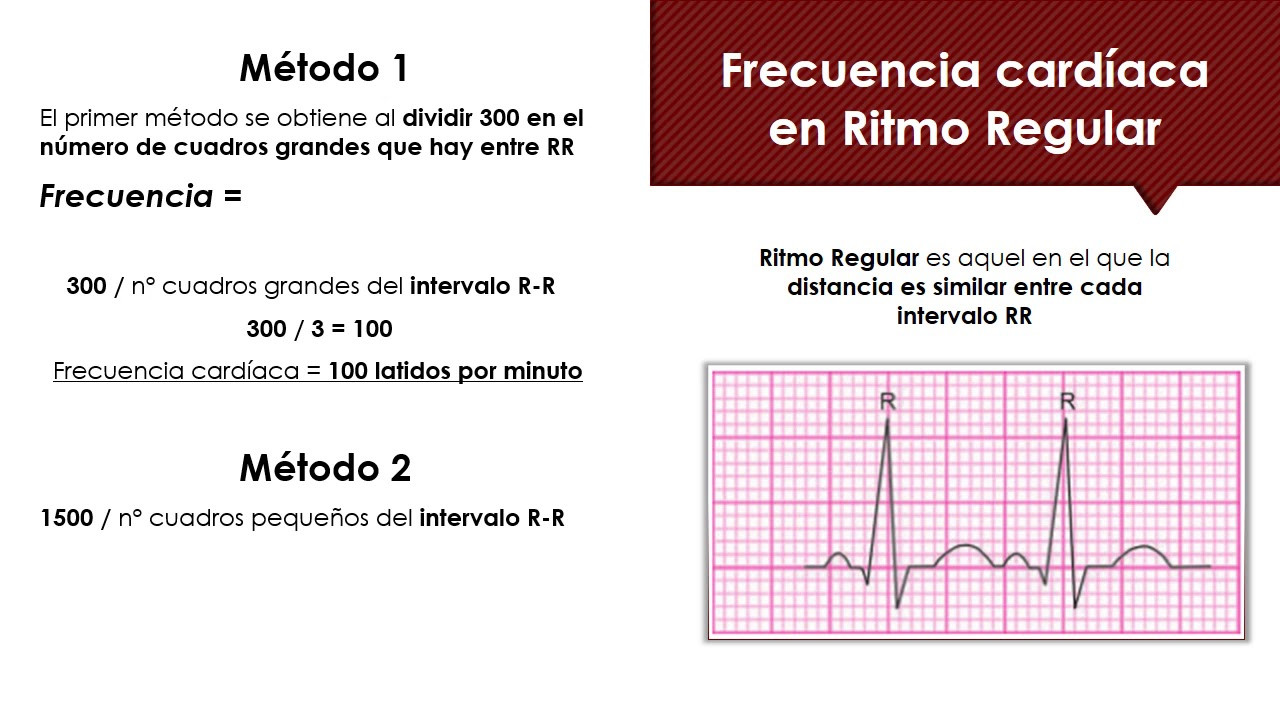 Guía Para Interpretar La Frecuencia Cardíaca En Un Ecg Neurat 4298